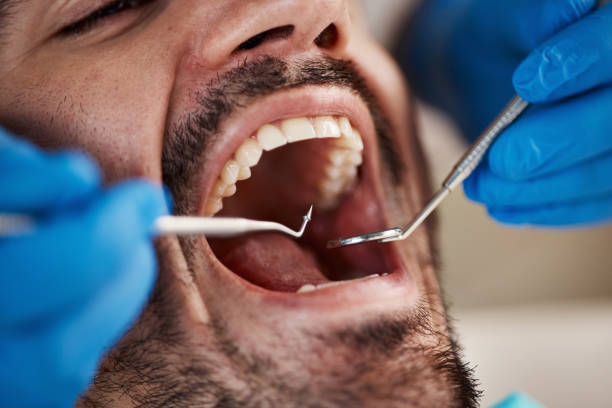 Oral Surgery in Junction, TX